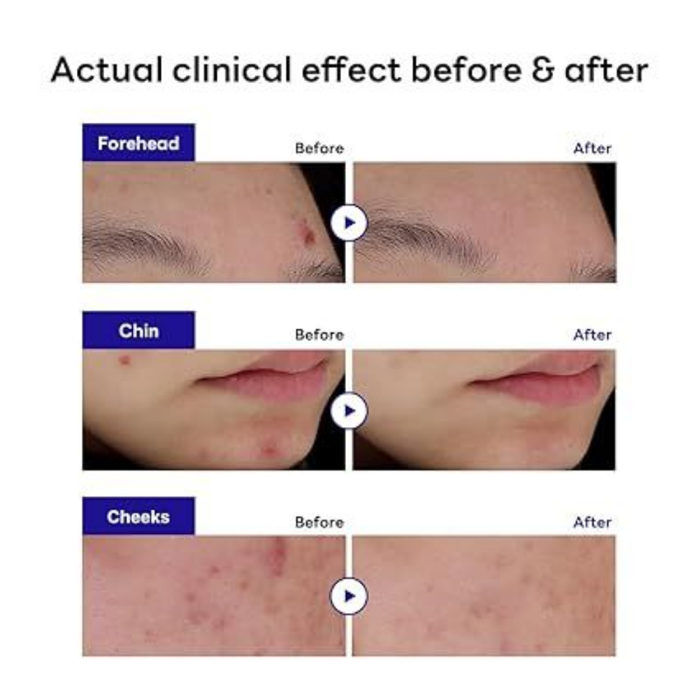 MEDIHEAL Derma Clear Madecassoside Blemish Spot Patch