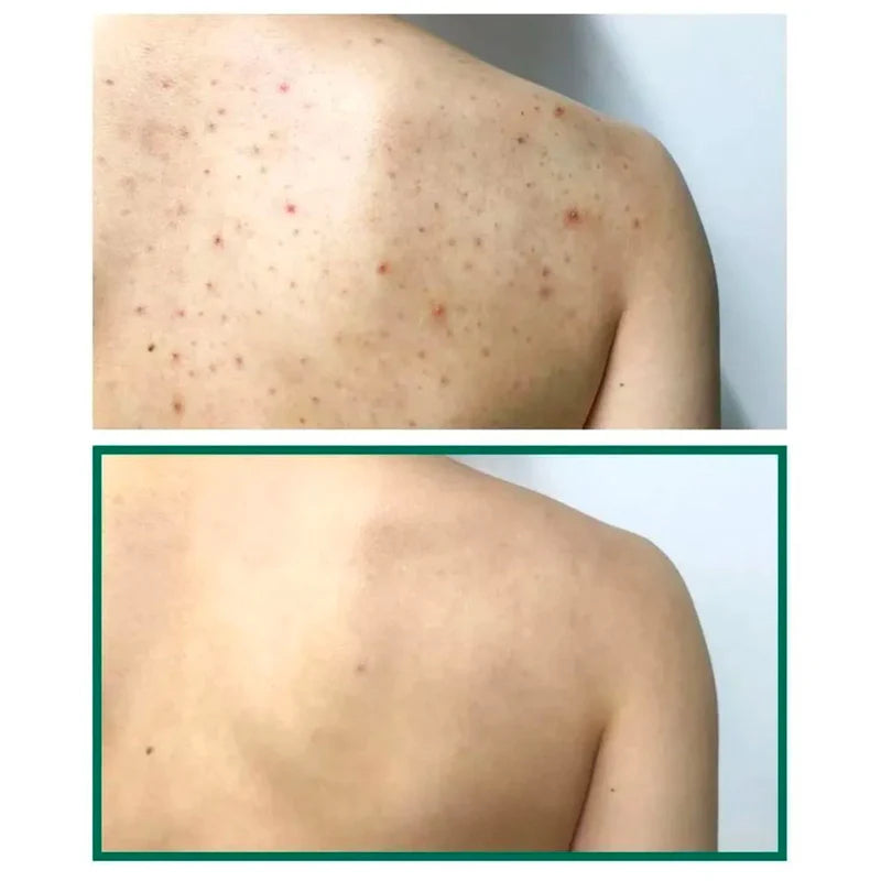 SOME BY MI AHA BHA PHA 30days Miracle Acne Clear Body Cleanser 400g